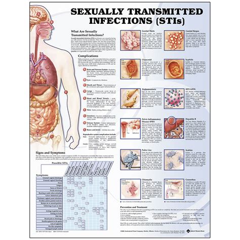 Sexually Transmitted Infections Poster 20 In X 26 In Sb2