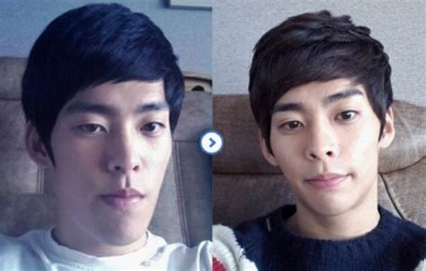 Crazy Before And After Photos Of South Korean Plastic Surgery Page 3