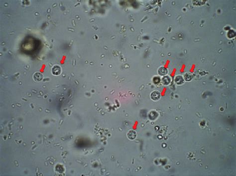 Cryptosporidium oocysts and three giardia cysts identified in each ipr sample should be. Observation microscopique de Cryptosporidium après ...