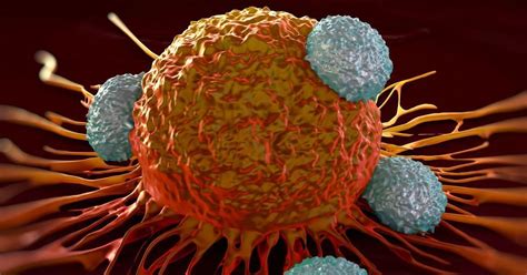 • ameli.fr (site web ) site de la cpam, contenant des informations tout public sur de très nombreux symptômes et maladies • inca (site web ) • association pour la vie des aplasiques et des leucémiques (association. Symptômes Leucémie