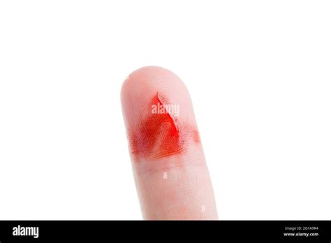 Cut Finger Blood High Resolution Stock Photography And Images Alamy