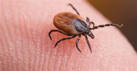 nhs lanarkshire chief executive reveals she contracted lyme disease after being bitten by tick