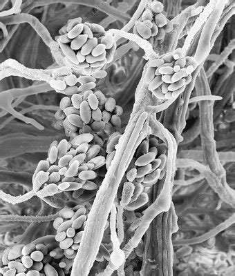 Stachybotrys Chartarum Toxic Mould Sem Stock Image C Science Photo Library