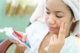 Photos of Pimple Home Remedies Toothpaste