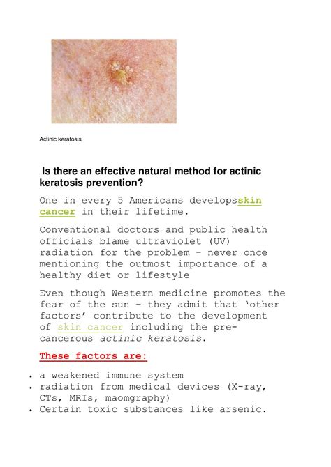 Effective Natural Method For Actinic Keratosis Prevention