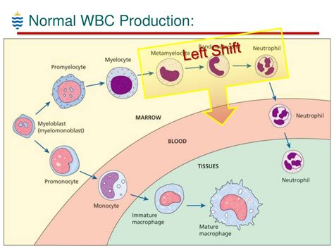 Ppt Pathology Of Wbc Disorders Powerpoint Presentation Free Download