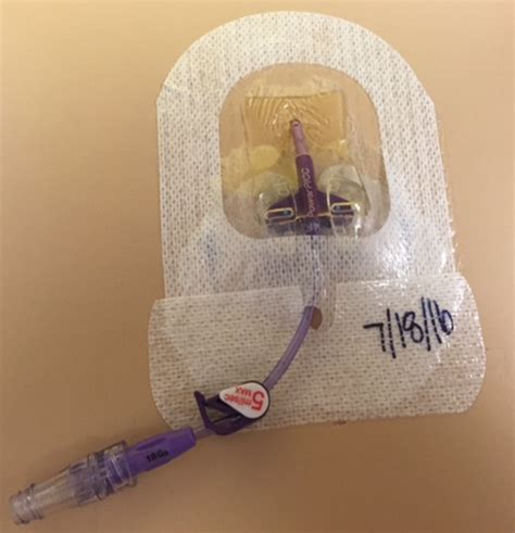 Understanding Your Peripherally Inserted Central Catheter Picc