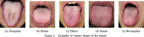 Features For Automated Tongue Image Shape Classification Semantic Scholar