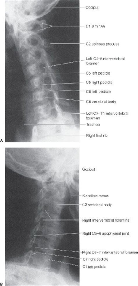 9 Spine And Pelvis Radiology Key