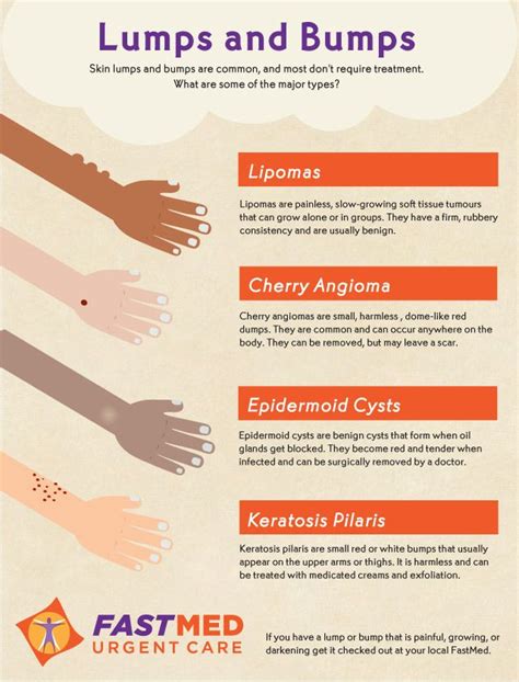 Whats Up With The Lumps And Bumps Infographic Migraines Remedies