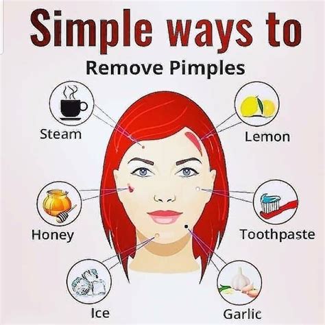 Simple Ways To Remove Pimples