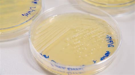 Researchers Explore Promising Treatment For Mrsa ‘superbug Cornell