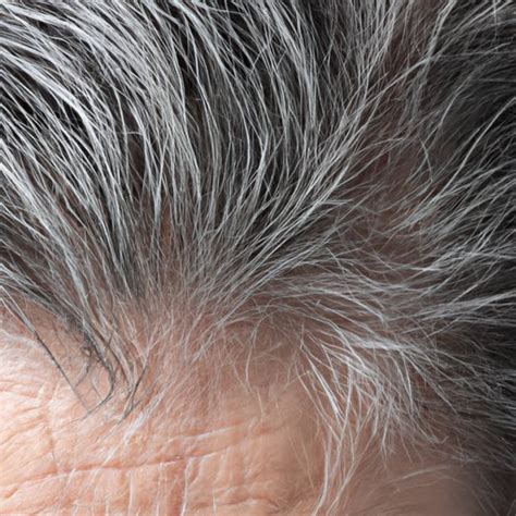 Why Does Hair Turn Grey An In Depth Look At The Causes And Treatments