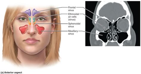 Chronic Sinusitis Causes Symptoms Surgery And Treatment