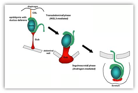 Etx Pediatrics Ch15 Fig14 Endotext