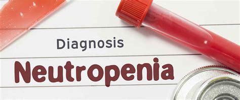 Neutropenia Definition Neutropenia Levels Causes Symptoms And Treatment