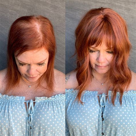 Crown Toppers Solutions For Top Thinning Hair — Spg Extensions And Color