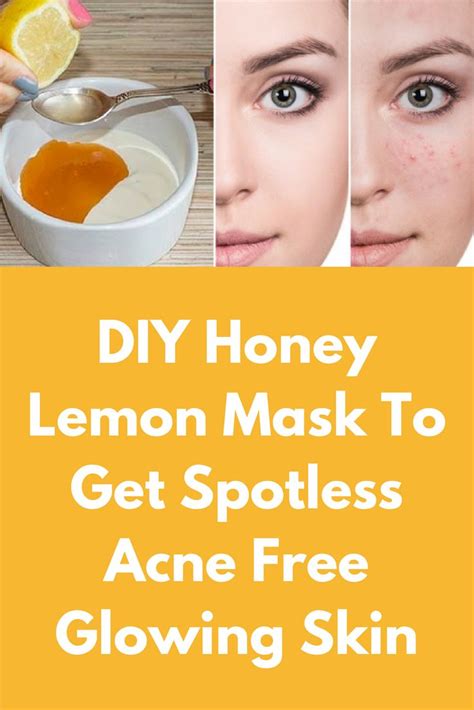 Diy Honey Lemon Mask To Get Spotless Acne Free Glowing Skin Today I