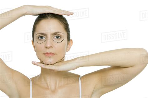 Woman With Plastic Surgery Markings On Face Framing Head With Hands