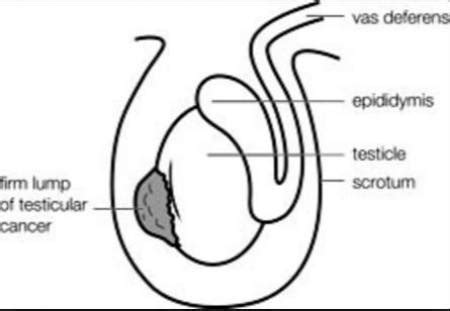 What Do Your Testicles Say About Your Health Thatviralfeed