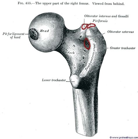 I will cover the following: Femur - Prohealthsys
