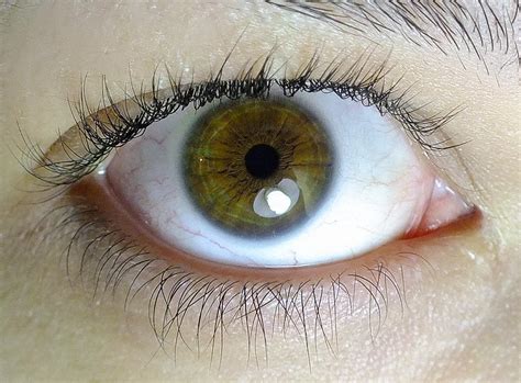 My Once Very Brown Eyes Are Turning Lighter And Green Is Starting To Up