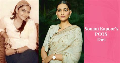 Sonam Kapoor Pcos Story Weight Loss Diet And Lifestyle Tips