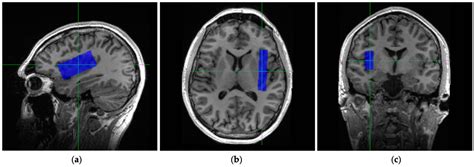 Brain Sciences Free Full Text Mr Spectroscopy Of The Insula Within