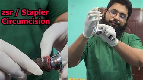 সরসর Stapler Circumcision দখন ZSR Circumcision In Bangladesh