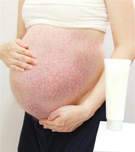 Rash On Face During Pregnancy Pregnancy Face Rash July 2017