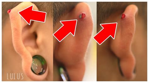 Troubleshooting Piercing Gone Wrong From Playing With It Too Much
