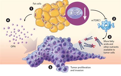 Infographic How Fat Cells Influence Tumor Growth The Scientist Magazine®