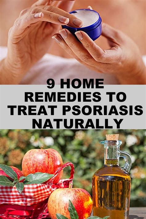 9 Home Remedies To Treat Psoriasis Naturally Treat Psoriasis Natural