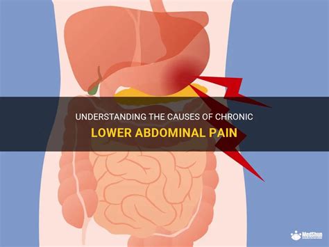 Understanding The Causes Of Chronic Lower Abdominal Pain MedShun