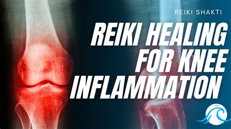 Reiki For Knee Inflammation Youtube
