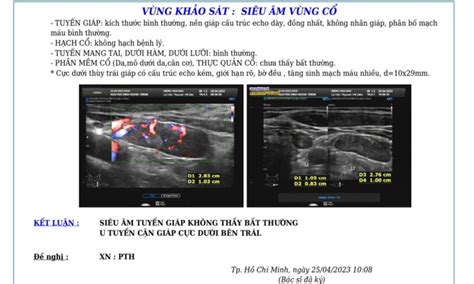 VIETNAMESE MEDIC ULTRASOUND CASE PARATHYROID TUMOR Dr PHAN THANH