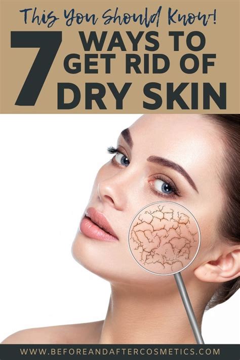 There Are People Who Have Naturally Dry Skin But Do You Know That You Can Develop Dry Skin Too