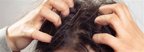 Swędzenie Skóry Głowy Objawy Przyczyny I Sposoby Leczenia Medovitapl