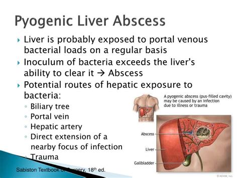 Ppt Liver Abscess Powerpoint Presentation Id1899096