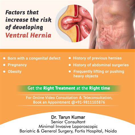 Dr Tarun Kumar Surgeon Factors That Increase The Risk Of Developing
