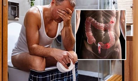 Bowel Cancer Symptoms Signs Include Pencil Thin Poo Uk