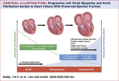 Atrial Dysfunction In Patients With Heart Failure With Preserved