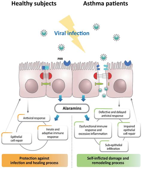 Ijms Free Full Text Viral Infection And Airway Epithelial Immunity