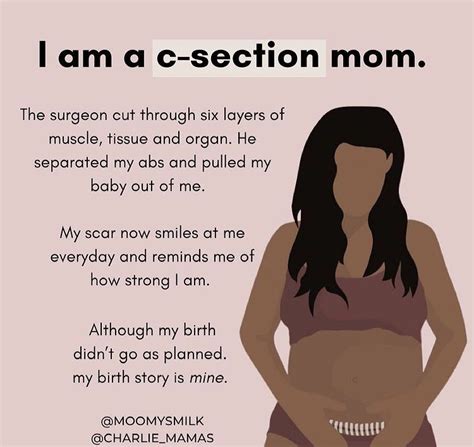 23 Truly Inspirational C Section Quotes For Scar Moms Artofit