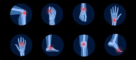 Your Guide to Diseases Managed by Rheumatologists | Empowered Arthritis