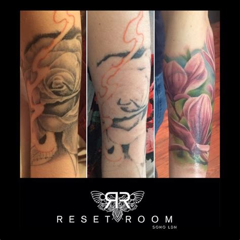 Pin By Reset Room On Laser Tattoo Removal Tattoo Removal Laser
