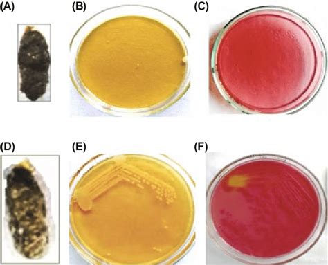 Stool Characteristics And Colonies On Lb And Macconkey Agar A Feces