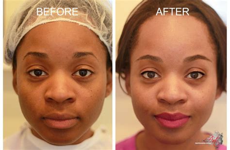 Microart For African Americans Microart Semi Permanent Makeup