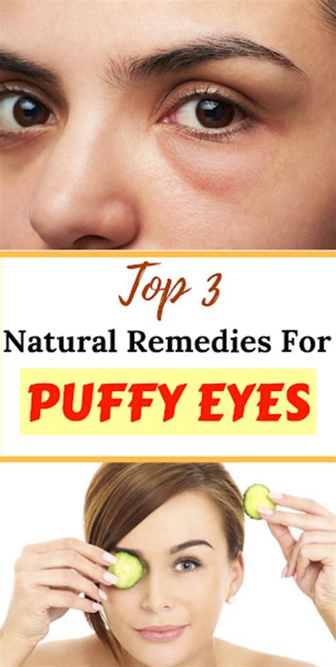 Top 3 Natural Remedies For Puffy Eyes Puffy Eyes Remedy Puffy Eyes Natural Remedies