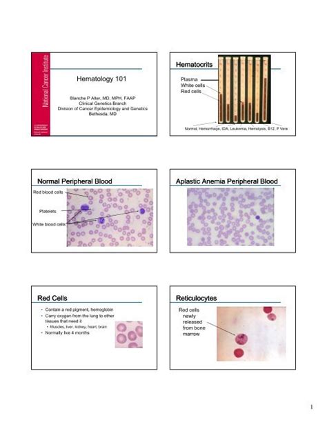 Aplastic Anemia Peripheral Blood